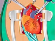 Jouer à Heart Surgery