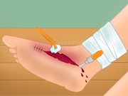 Jouer à Leg surgery