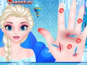 Jouer à Doctor Frozen Elsa Hand