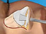 Jouer à Nose job plastic surgery game