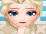 Jouer à Squeeze elsa pimples