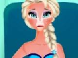 Jouer à Elsa sunburn