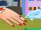 Jouer à Manicure after injury