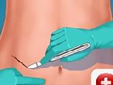 Jouer à Appendix surgery