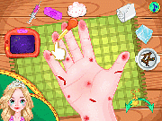 Jouer à Princess Anna Hand Doctor