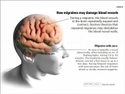 Jouer à Migraine