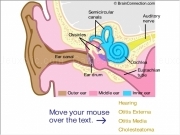 Jouer à Auditory pathology